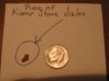 Kidney_Stone.jpg