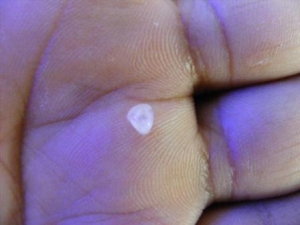 Snail Egg