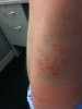 stung.jpg