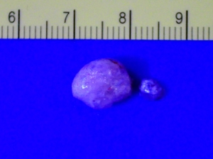 Halichoeres chrysus Tumor (1)