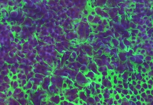 Toxic Spill Montipora