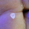 Snail Egg